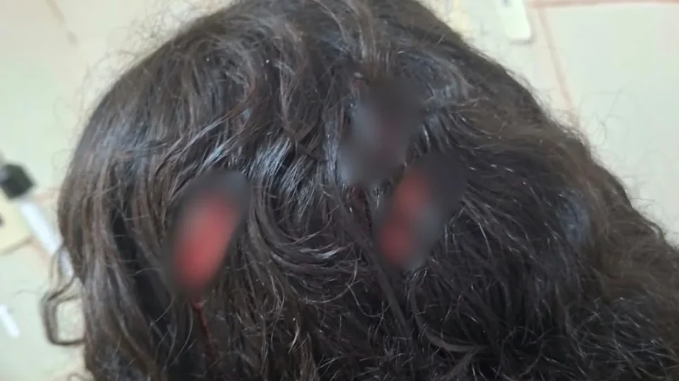 BRIGA EM ESCOLA| Estudante de 13 anos é apreendido após esfaquear colega